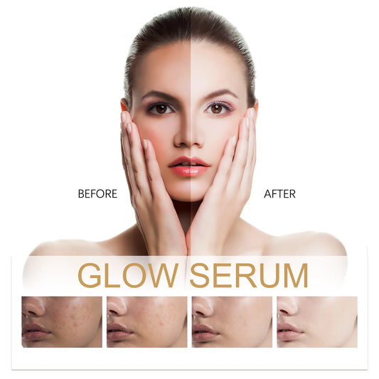 Sérum Glow Propolis & Niacinamide eelhoe 30ml – Éclat, Hydratant & Anti-Taches | CPNP