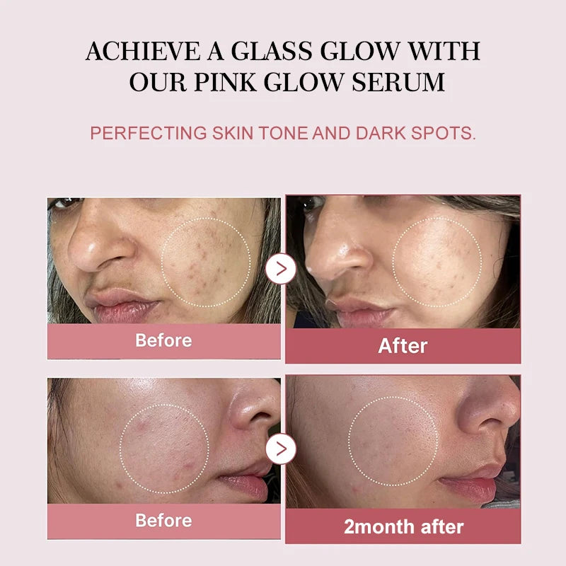 Sérum Anti-Acné Peptides & PDRN Collagène – Pores Affinés, Éclat & Teint Unifié