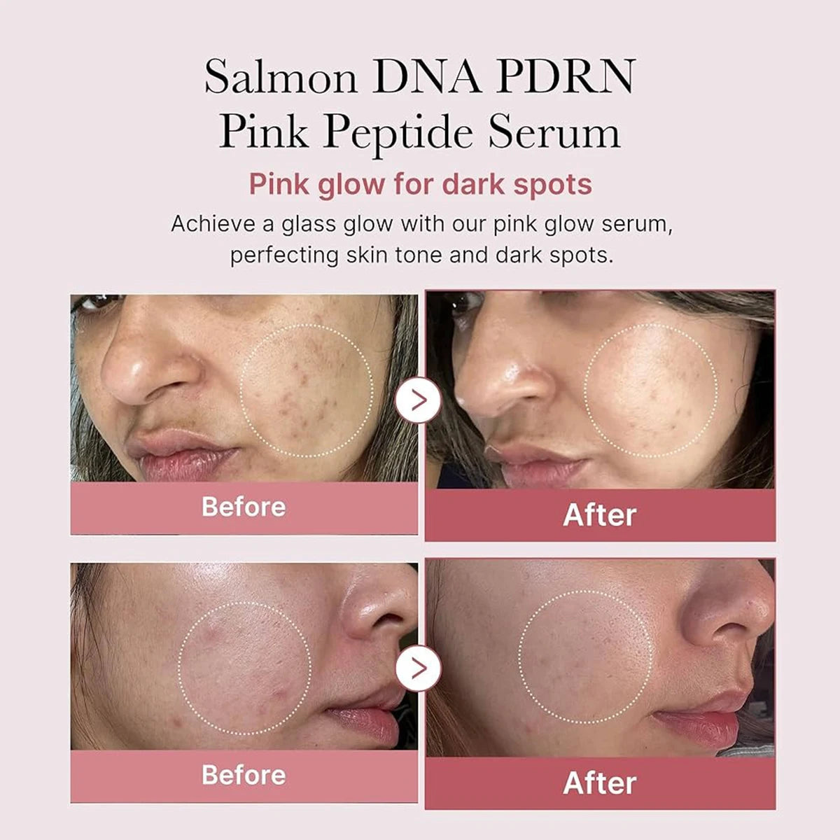 Sérum Visage Medicube PDRN Pink Peptide – Fermeté & Réparation K-Beauty