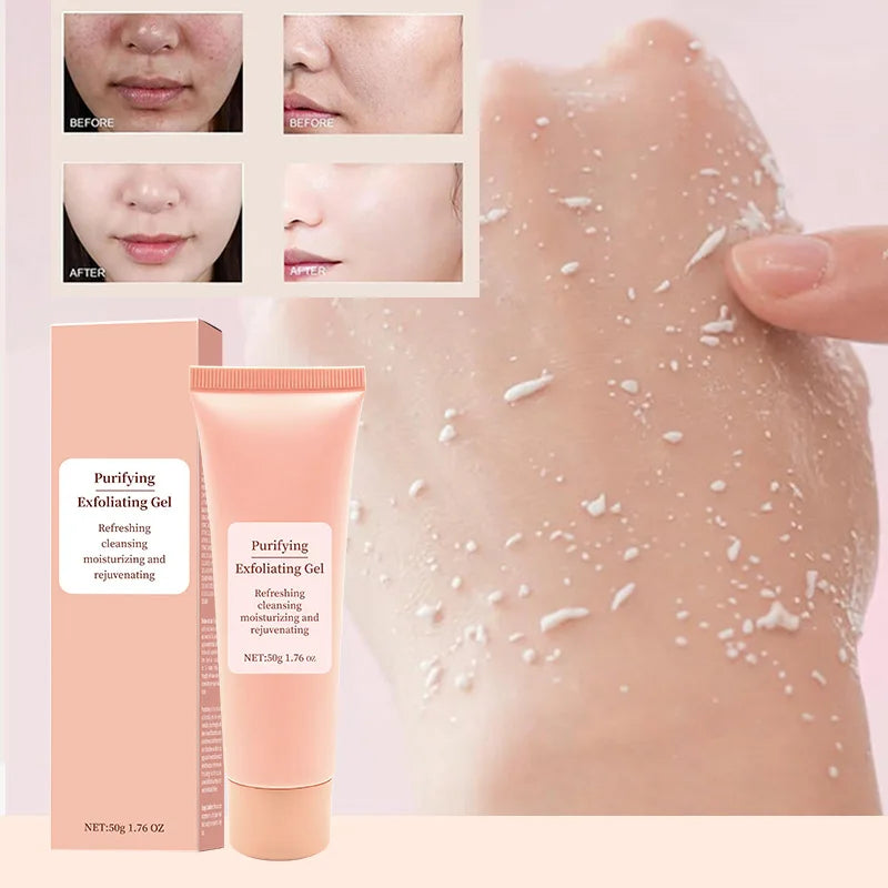 Gel Exfoliant Visage 50g – Gommage Doux, Nettoyage des Pores & Contrôle du Sébum