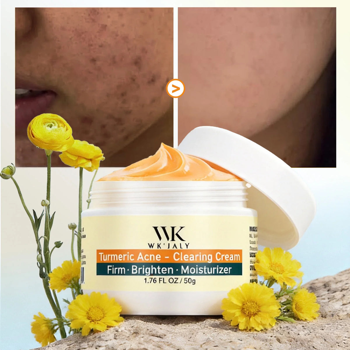 Crème Visage WK JALY au Curcuma – Anti‑Acné, Anti‑Taches & Éclat du Teint