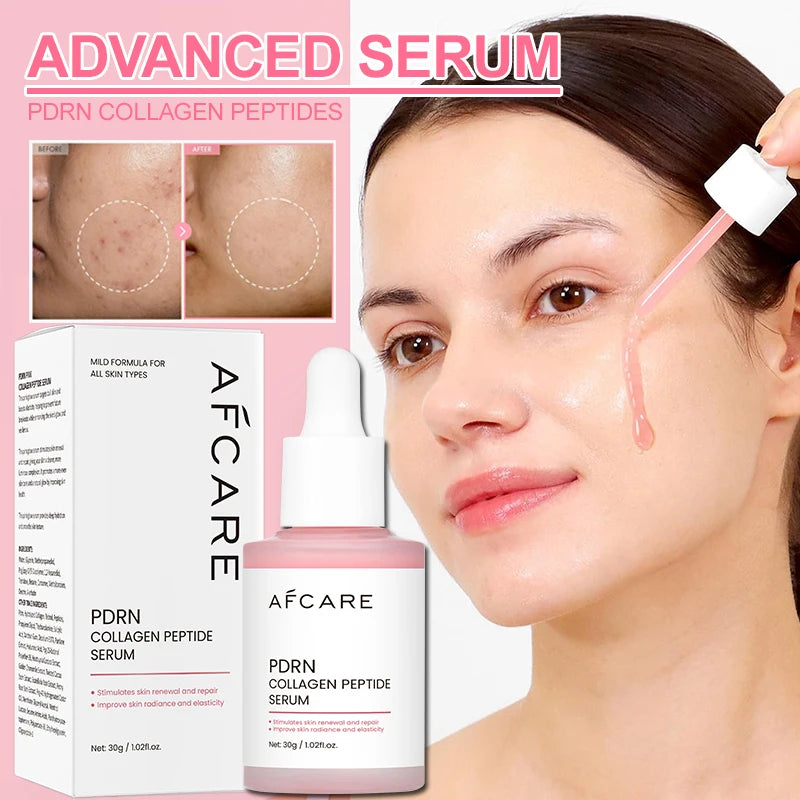 Sérum Anti-Acné Peptides & PDRN Collagène – Pores Affinés, Éclat & Teint Unifié