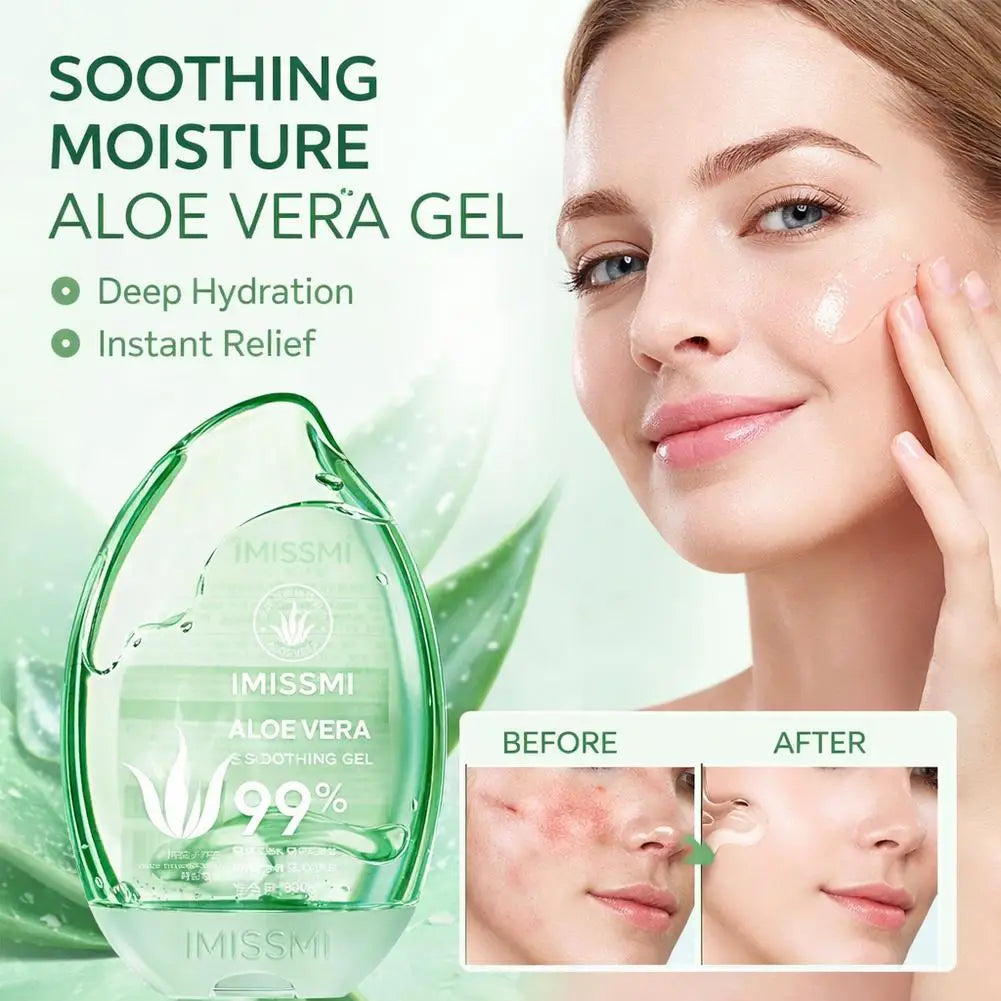 Gel Apaisant à l'Aloe Vera 99% – Hydratant, Réparateur & Anti-Coup de Soleil (300g)