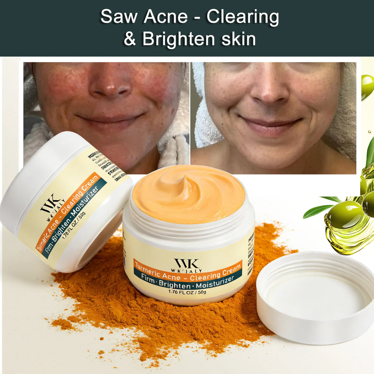 Crème Visage WK JALY au Curcuma – Anti‑Acné, Anti‑Taches & Éclat du Teint