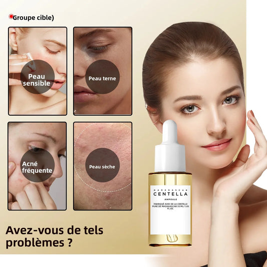 Sérum Apaisant Peaux Sensibles 55ml – Formule Centella de Madagascar